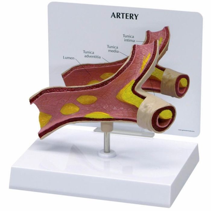1019531_Arterienmodell 1019531_Arterienmodell