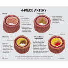 1019532_03_1200_1200_Arterienabschnitte-4-ueberdimensioniert-mit-Griff