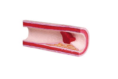 G2451_1uxQvh1WF1CzBE